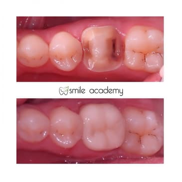 Slider image (7) Esthetic Smile Academy 